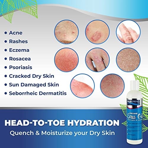 EMU-3158: 8-oz. Pure Prime Emu Oil, Get 1 Super White Stuff OTC 3-oz. roll-on at Half Price Plus Free Shipping - 44% OFF Market Prices!